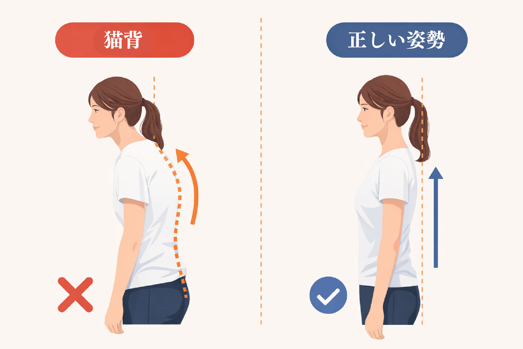 猫背ビフォーアフター