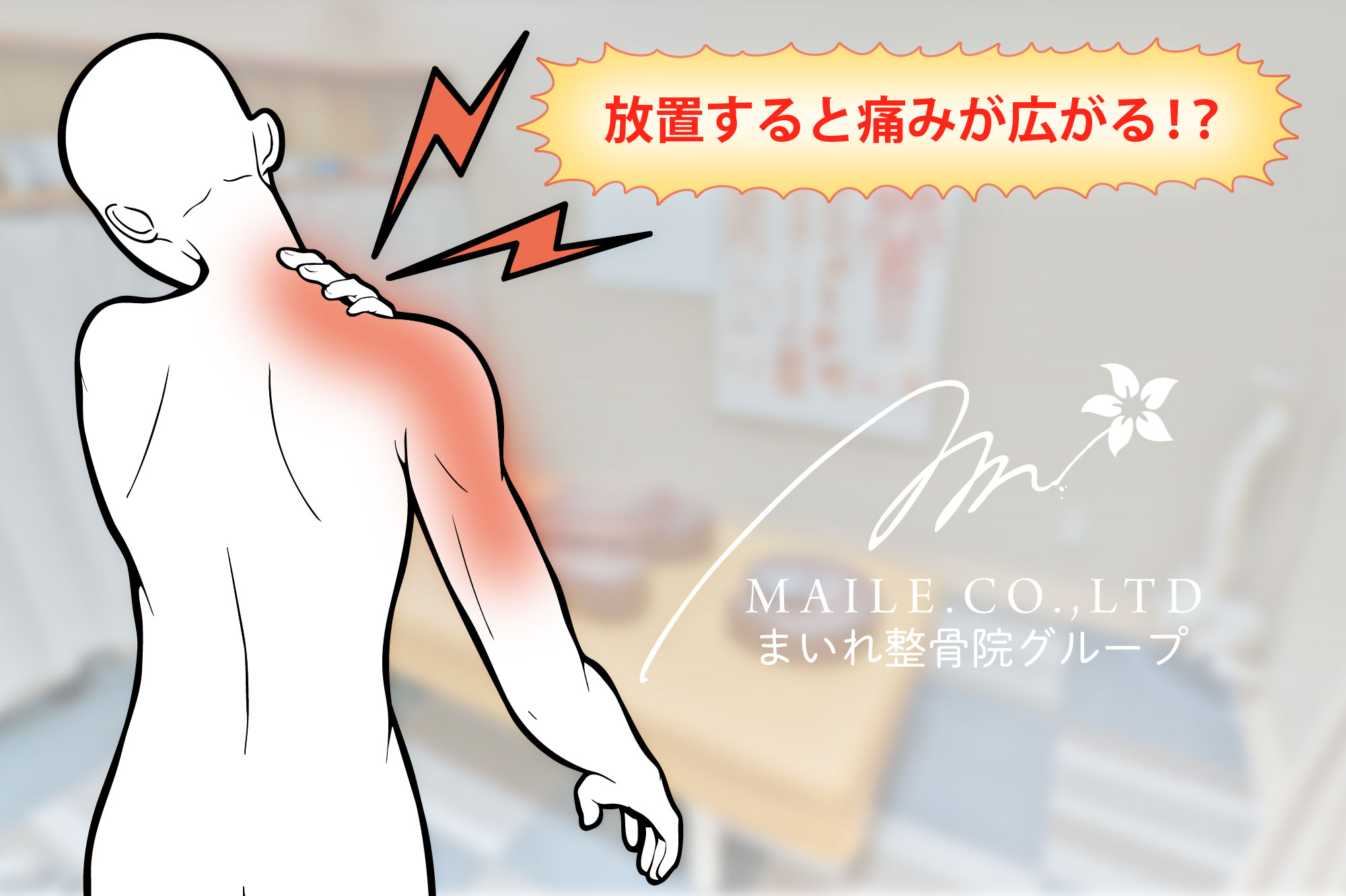 肩こり放置危険